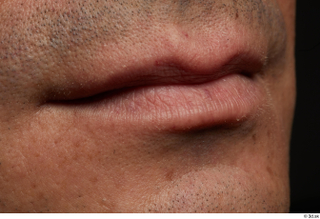 HD Face Skin Harrison Hill face lips mouth skin pores…